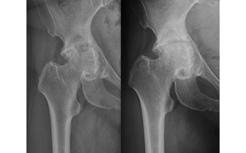 fysioterapeft stockholm