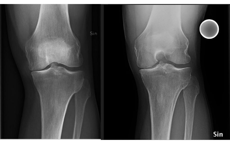 fysioterapeft stockholm