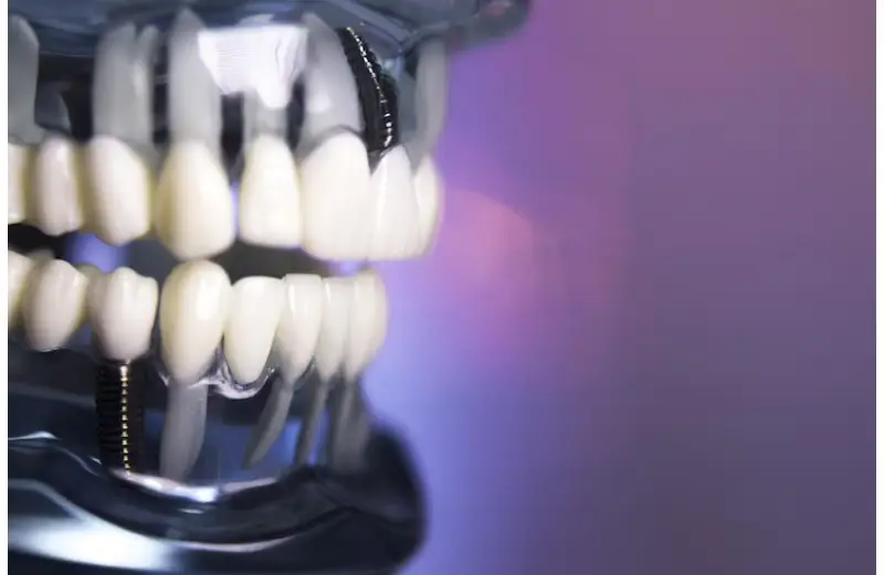 https://primedentalbroward.com/all-on-4-dental-implants-pembroke-pines/