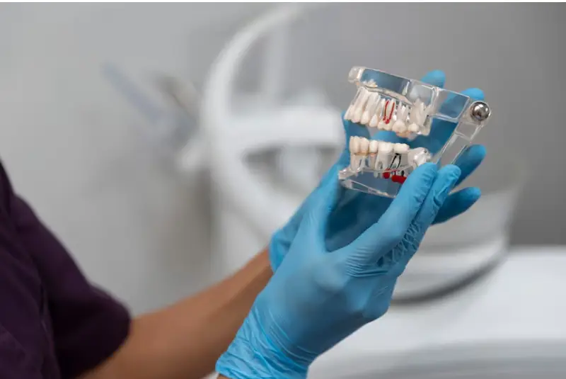 Why Pembroke Pines Is Ideal for All-on-4 Implants Today?