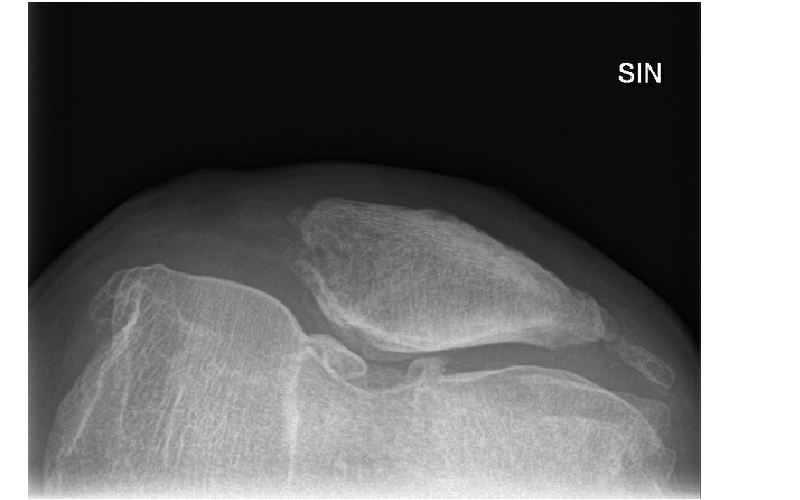 Fysioterapeut I Stockholm Kan Hjälpa Dig Att Upprätthålla En Aktiv Livsstil