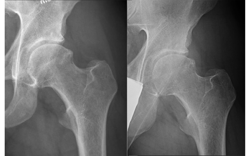Rabatter för Vanliga Patienter På Fysioterapift Stockholm
