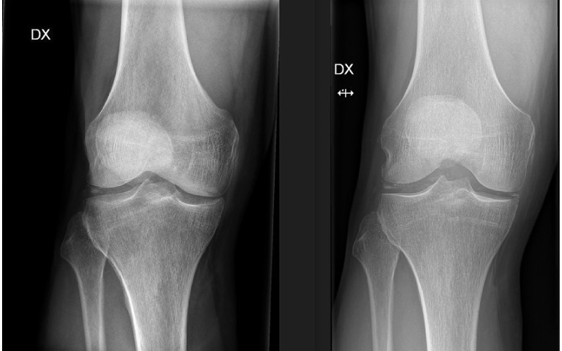 Håll Dig Motiverad Under Din Fysioterapeut I Stockholm