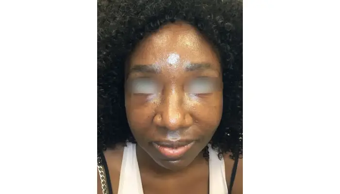 Finding The Best Acne Specialist In Austin: Your Guide To Clear Skin Solutions