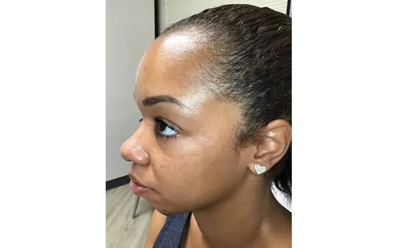 Innovative Treatments At A Skin Clinic In Austin